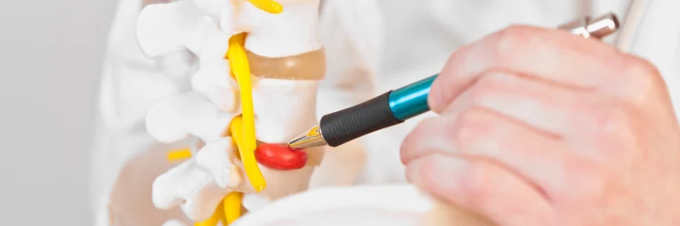 Tampa FL Chiropractor Discusses Herniated Discs